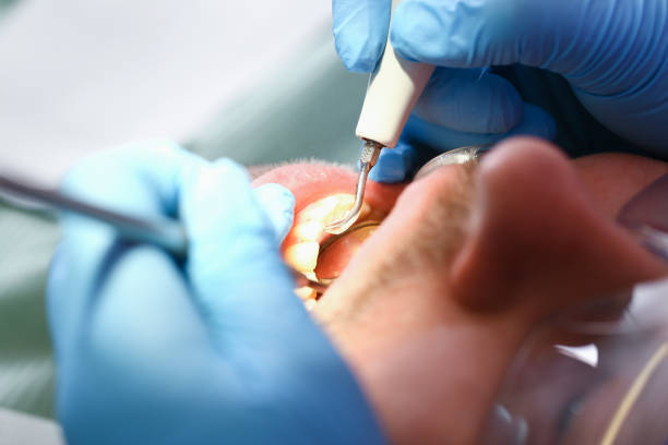 Best After-Hours Emergency Dentist in Magnolia, NC